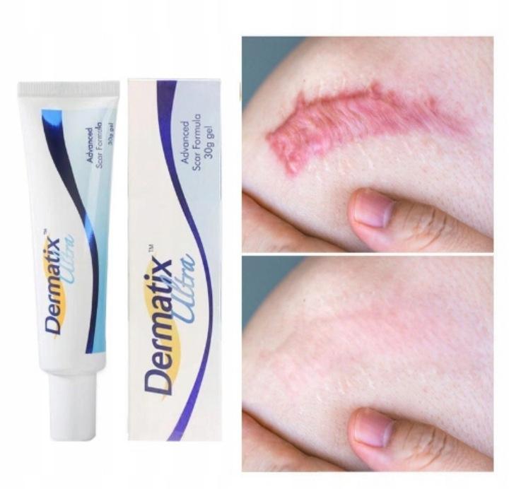 Dermatix Ultra Silikonowy Żel Do Leczenia i Zapobiegania Blizn 15g