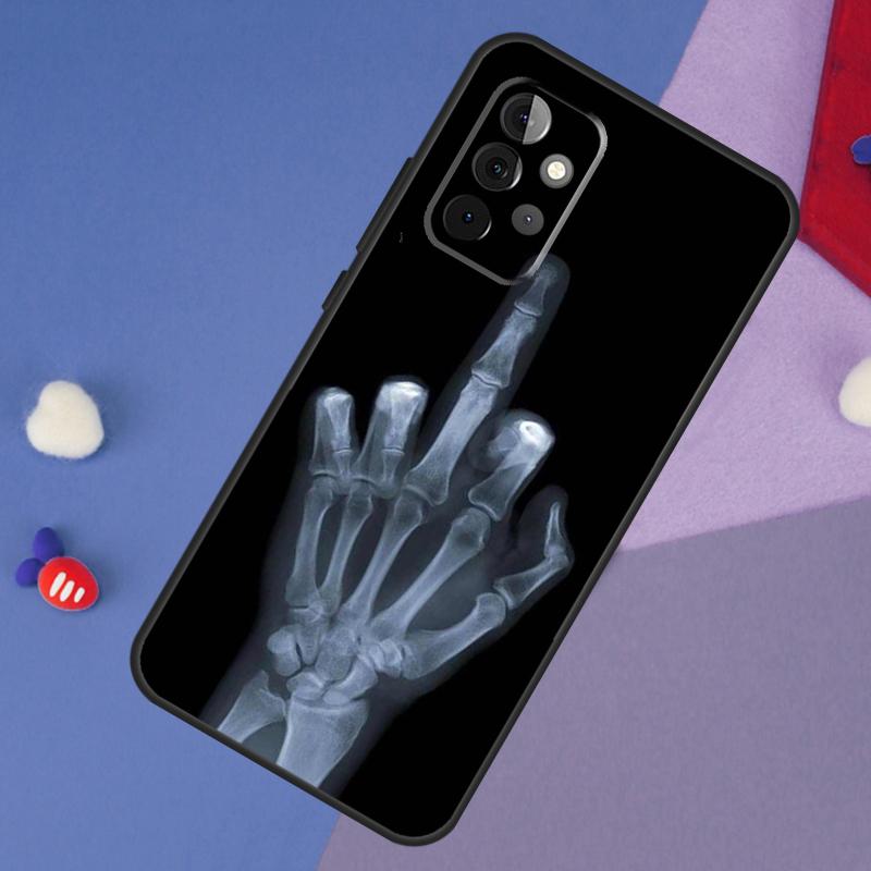 Skeleton Middle Finger Case For Samsung Galaxy A14 A56 A36 A26 A16 A06 A54 A34 A12 A32 A52 A13 A33 A53 A15 A35 A55