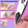 Xiaomi 1/2pcs Ingrown Toenail Clipper Set Stainless Steel Sharp Blades for Thick Hard Ingrown Nails Rebound Effort-Saving Design