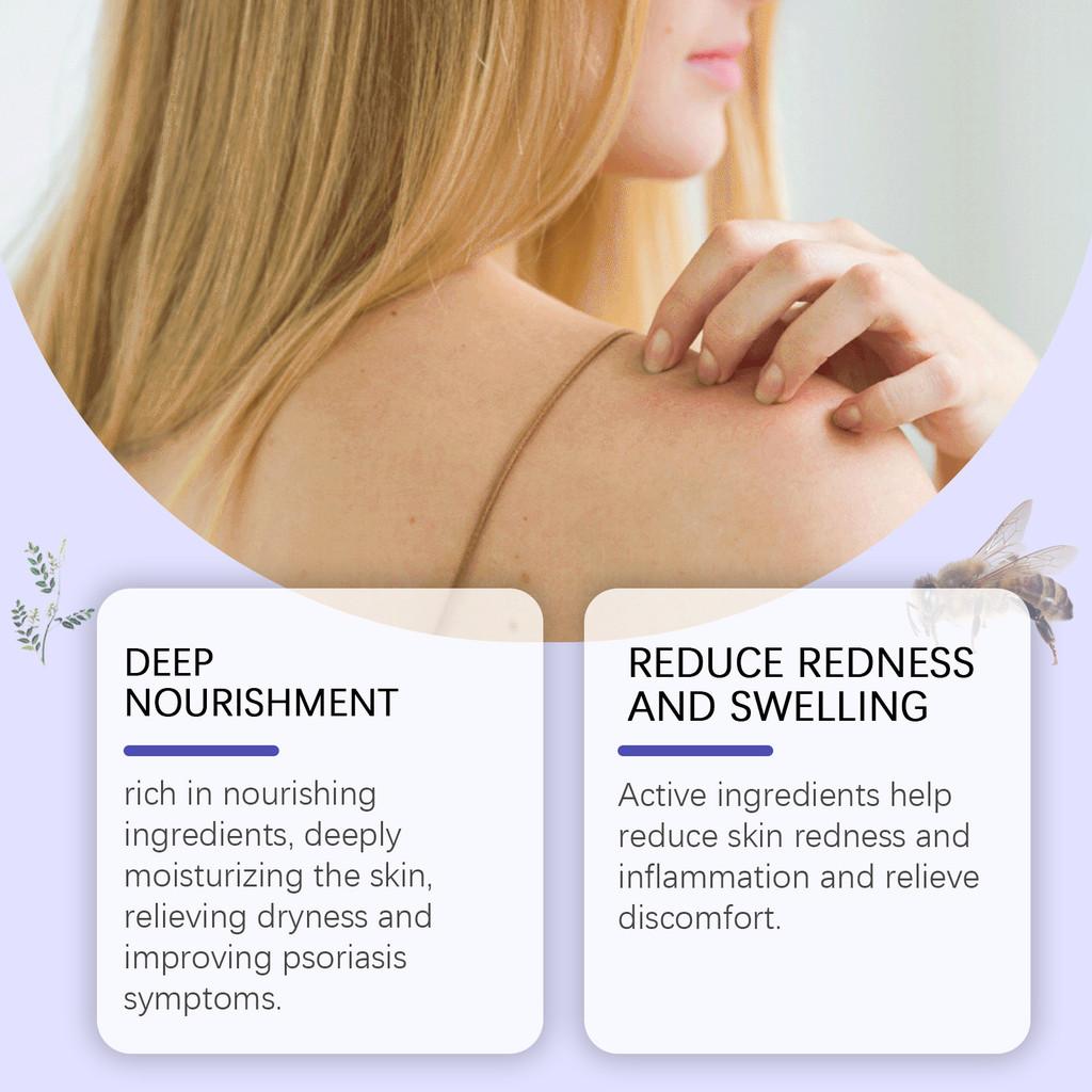 South Moon Skin Care Cream Gentle Cleansing Relieves Discomfort Hydrates Skin