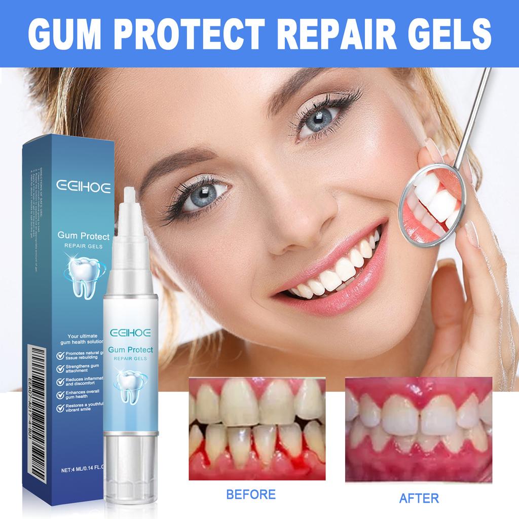 Damaged Gum Repair Care Gel Deep Cleaning Effectively Removes Yellow Teeth Stains Tartar Fresh Breath Teeth Cleaning Gel 4ml