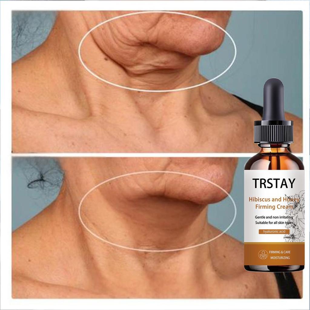 Ginger Neck Cream Organically Brightens the Skin Tone, Tightens the Skin, and Makes It Smooth and Delicate