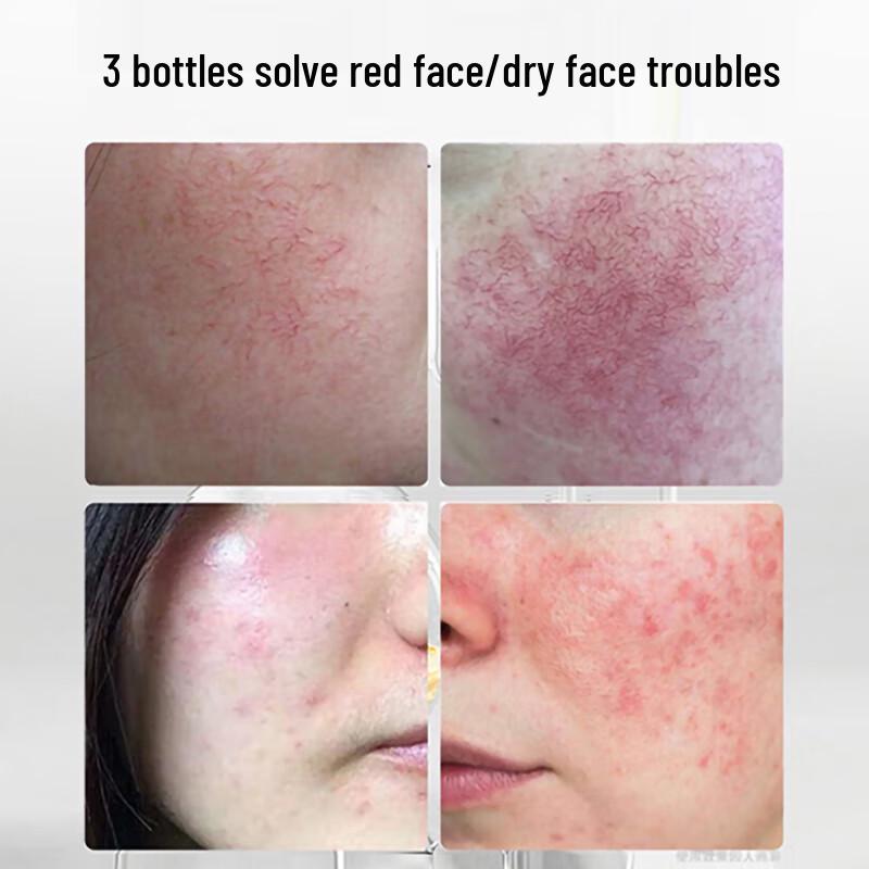 Meiyanfang B5 Repair Cream