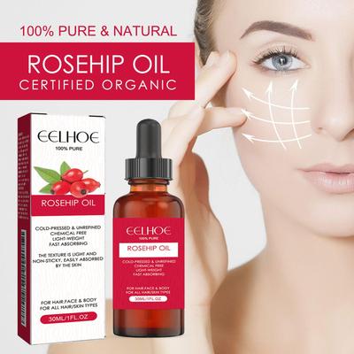Olio di Rosa Mosqueta Biologico, Nutrimento Intenso, Migliora l'Aspetto di Cicatrici, Smagliature, Linee Sottili e Rughe