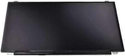 Lenovo 15.6" Display 00Ur886, 39.6 Cm (15.6 Inch), 00Ur886