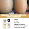 Foot Exfoliation Spray Repair Dead Skin and Calluses Whitening Care Spray