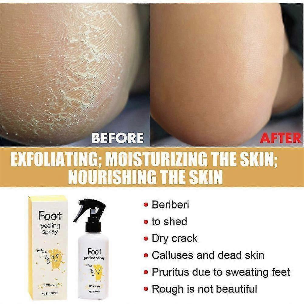 Foot Exfoliation Spray Repair Dead Skin and Calluses Whitening Care Spray