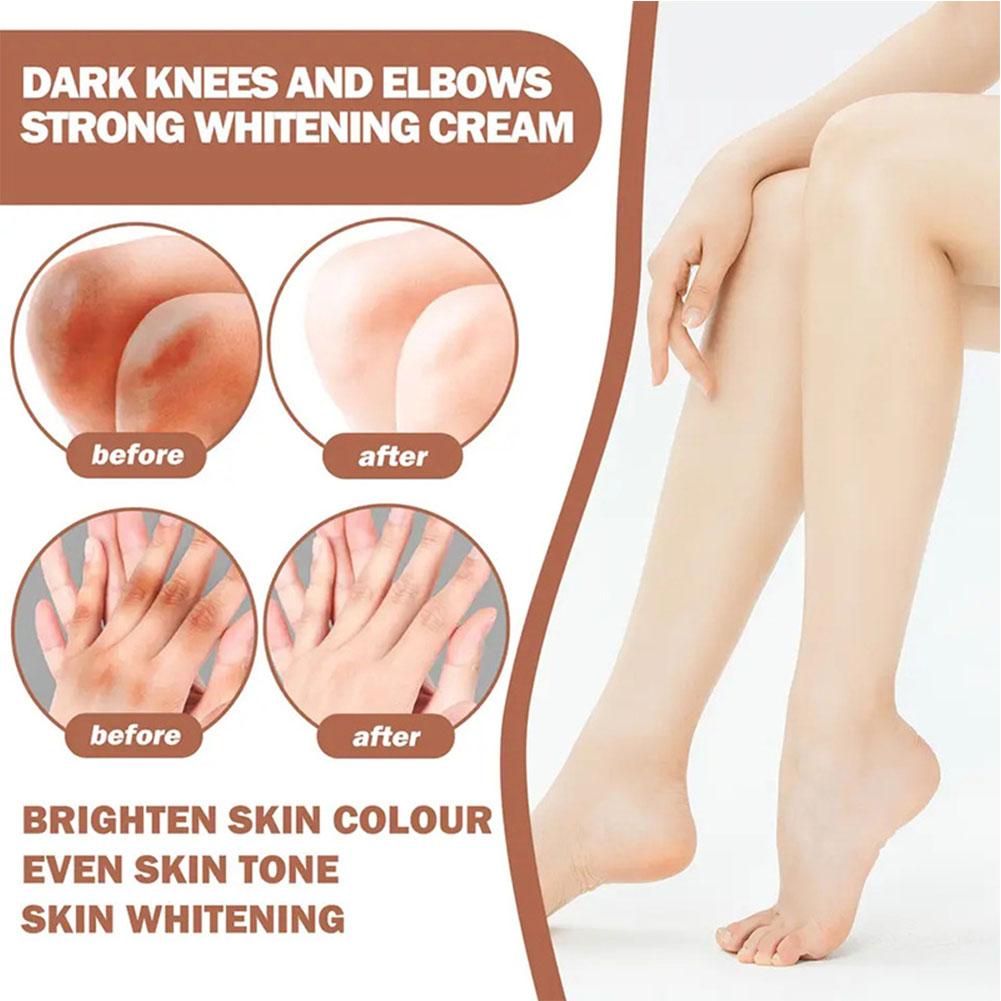 Fast Whitening Dark Knuckles Cream Pigmentation Correctors Intense Elbows Knee Skin Stains Crea T2S9