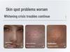 Whitening Repair Toner: Brightens, Reduces Spots, Niacinamide Infused, High-End Skincare