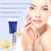 Acne Cream,Acne Cream For Face,Reduce Acne, Control Oil, Remove Dullness, 1pc  20g