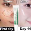 Salicylic Acid Pore Clearing Cream Shrink Pores Remove Blackheads Acne Brighten Moisturizing Smooth Skin Care Korean Products