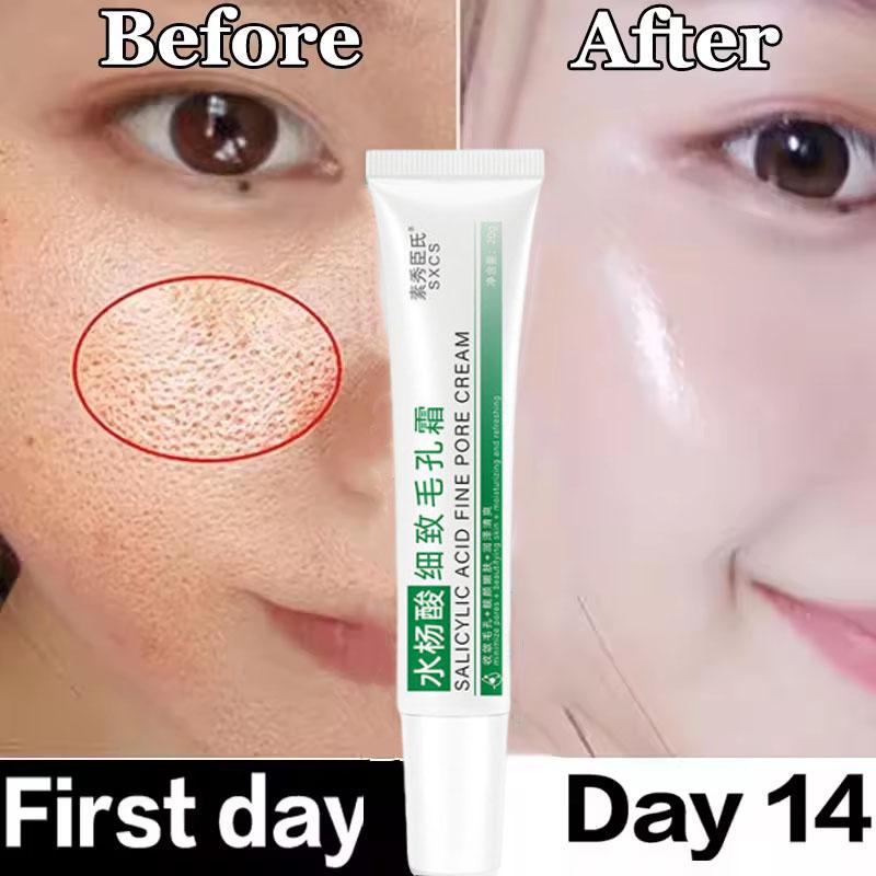 Salicylic Acid Pore Clearing Cream Shrink Pores Remove Blackheads Acne Brighten Moisturizing Smooth Skin Care Korean Products