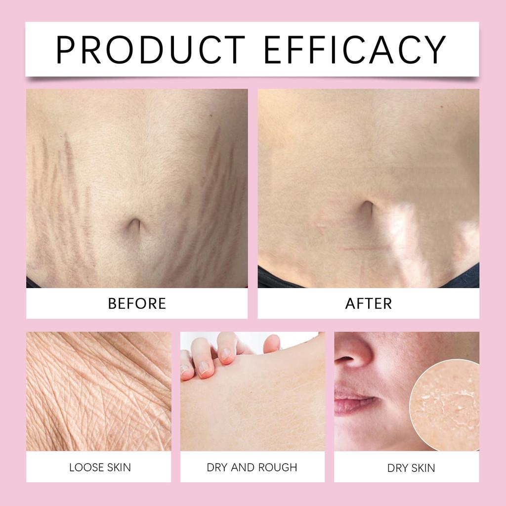 Nourishing Moisturizing Body Lotion For Silky Smooth Skin And Gentle Skin Repair 150ml For Luxurious Body Care