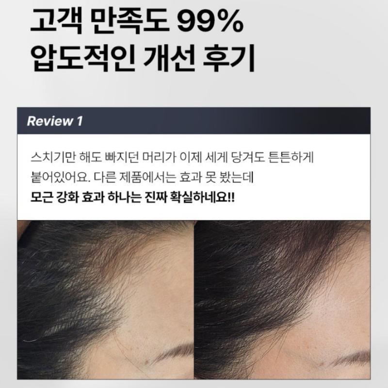 [TRICONIX] Trico X Kopfhautampulle 30ml