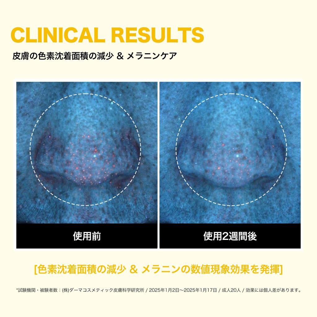 SOME BY MI Yuja Niacin Daily Mask Face mask with yuzu fruit and vitamin Korean Anti-Blemish (30 sheets, 370ml) - niacinamide, extract, arbutin, C.