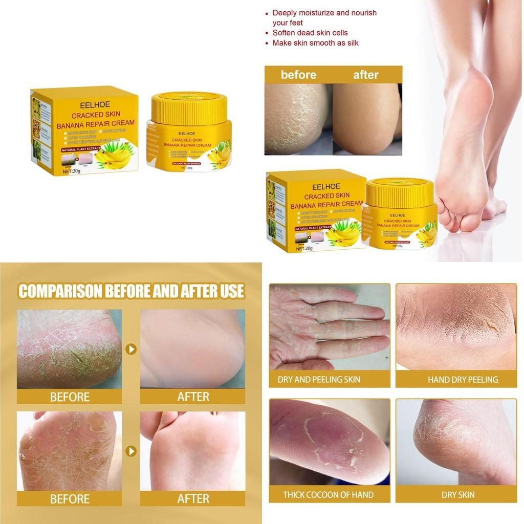 Eelhoe Skin Crack Banana Repair Cream Nourishing Foot Cream For Dry Cracked Skin