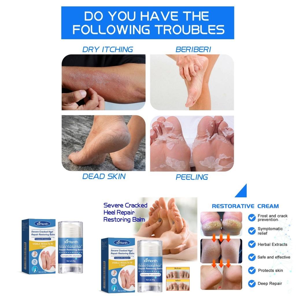 Ximonth Heel Repair Cream For Cracked Dry Skin Nourishing Moisturizing Foot Care 40g