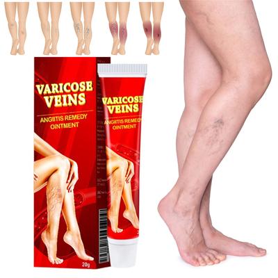 Venoheal pasta nuo varikozinių venų, pasta nuo varikozinių venų, kojų venų varikozės ir vorinių venų palengvinimo priemonė, gerinanti kraujotaką