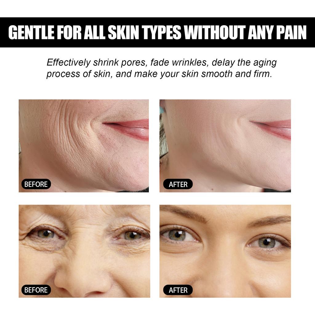 EELHOE Vitamin C Pore Shrink Face Serum Hyaluronic Acid Moisturizing Nourish Smooth Pores Repair Essence Firm Korean Cosmetics