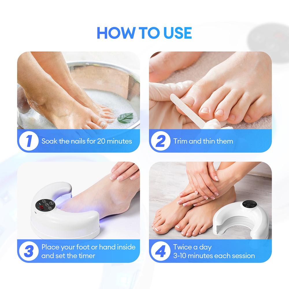 Wireless Hand Foot Nail Nail Fungus Laser Device Toenail Fungus Treatment Lamp Infrared Blue Light Anti Fungal Laser Nail Lamp
