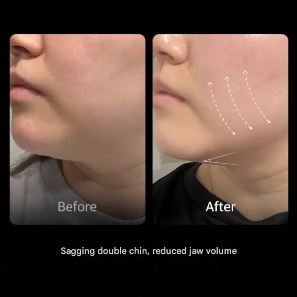 Medicube [AGE‑R] Disparo de Alta Concentración