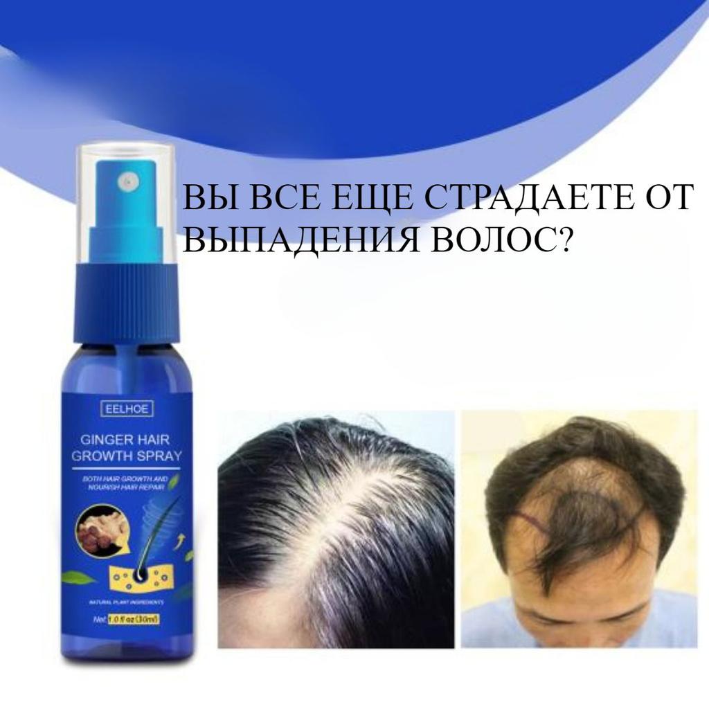 30ml Ginger Hair Growth Spray Scalp Nourishing Thick Hair Hair Care Nutrient Spray