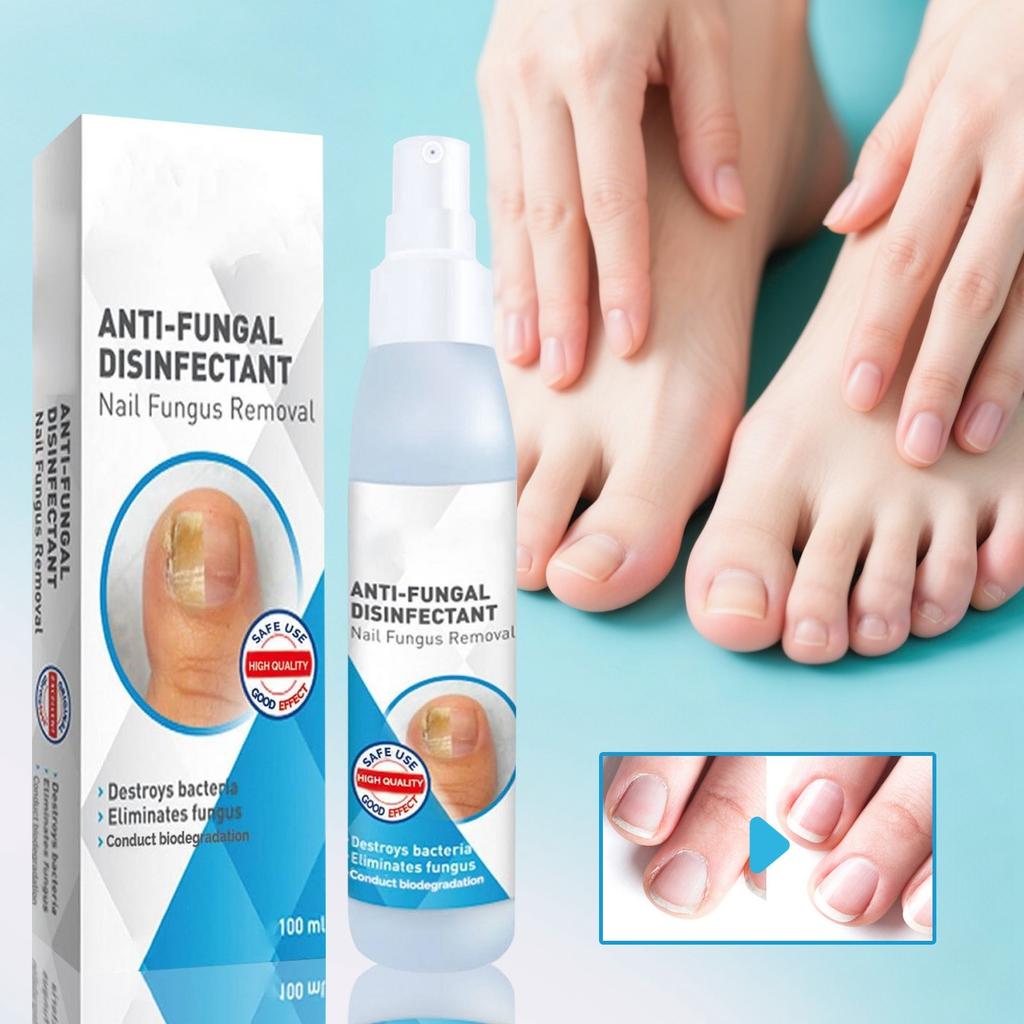 Spray pour Soin des Ongles Nourrit la Peau et les Ongles, Améliore l'Apparence et l'Odeur, 100ml