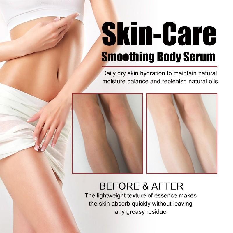 Eelhoe Body Care Essence Nourishing Firming Gel For Belly Arms And Thighs