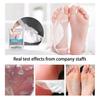 LANBENA Exfoliating Foot Peel Mask Remove Dead Skin Foot Mask Peeling Cuticles Heel 1/3/5 Pairs