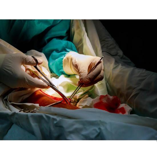 Gdc Scissors With TC Tip