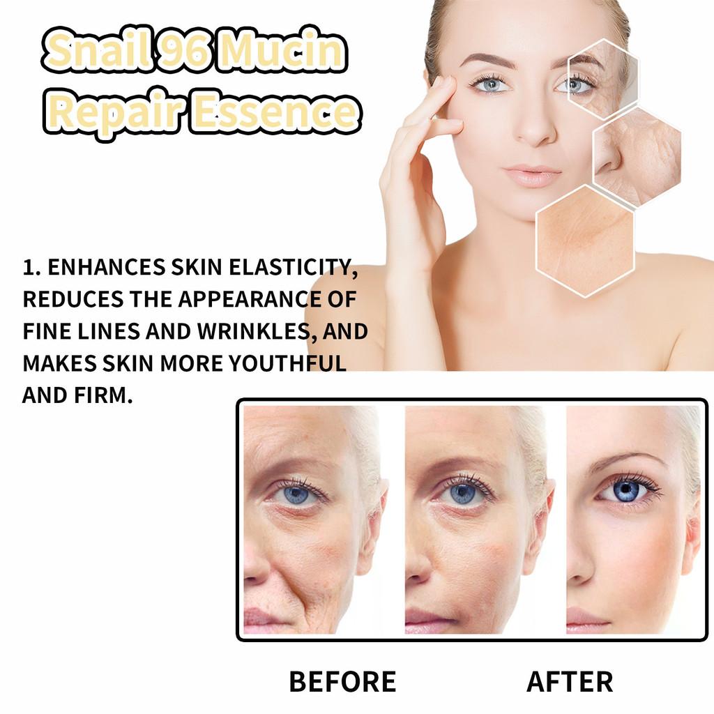 Hoygi Snail Collagen Essence Serum For Youthful Skin Hydration And Fine Line Reduction