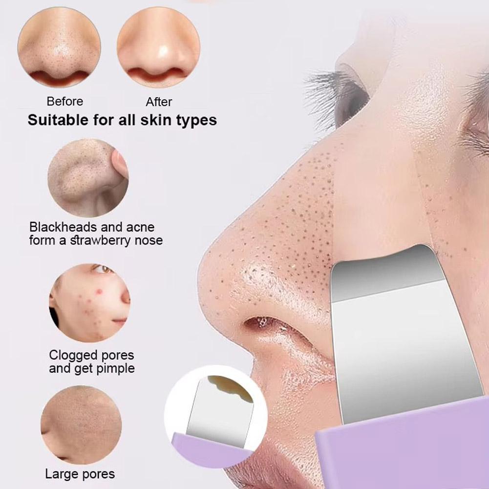 Stainless Steel Blackhead Removal Tool Deeply Cleanses Pores Gently Exfoliates For Face Beauty Skin Care Tool