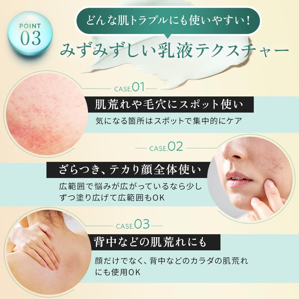 Bohatá směs surové azelaové vhodné pro japonský SISI Smart Activator 30g Krém s kyselinou azelaovou Cica CICA Kontrola séba Póry Vyrobeno v Japonsku [Obsahuje