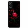 For TCL 50 SE Case Funny Painted Soft Silicone Back Cover for TCL 50 XE TPU Cool Skeleton Hand Protective Bumper Coque TCL 50