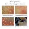 Professional Skin Hair Detector Scalp Hair Follicle Moisture Skin Pores Pigment Magnifying Analyzer Skin Pigment Tester 11 Inch