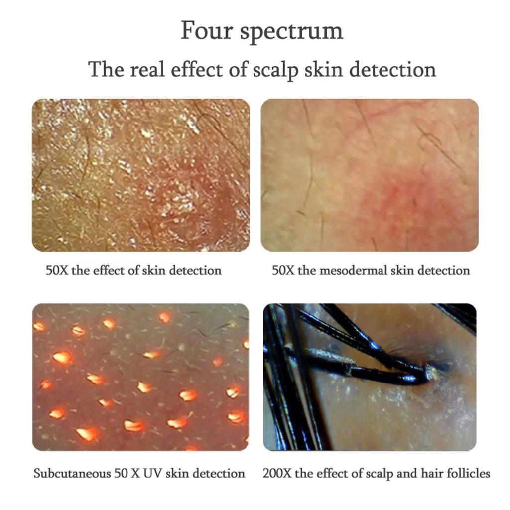 Professional Skin Hair Detector Scalp Hair Follicle Moisture Skin Pores Pigment Magnifying Analyzer Skin Pigment Tester 11 Inch