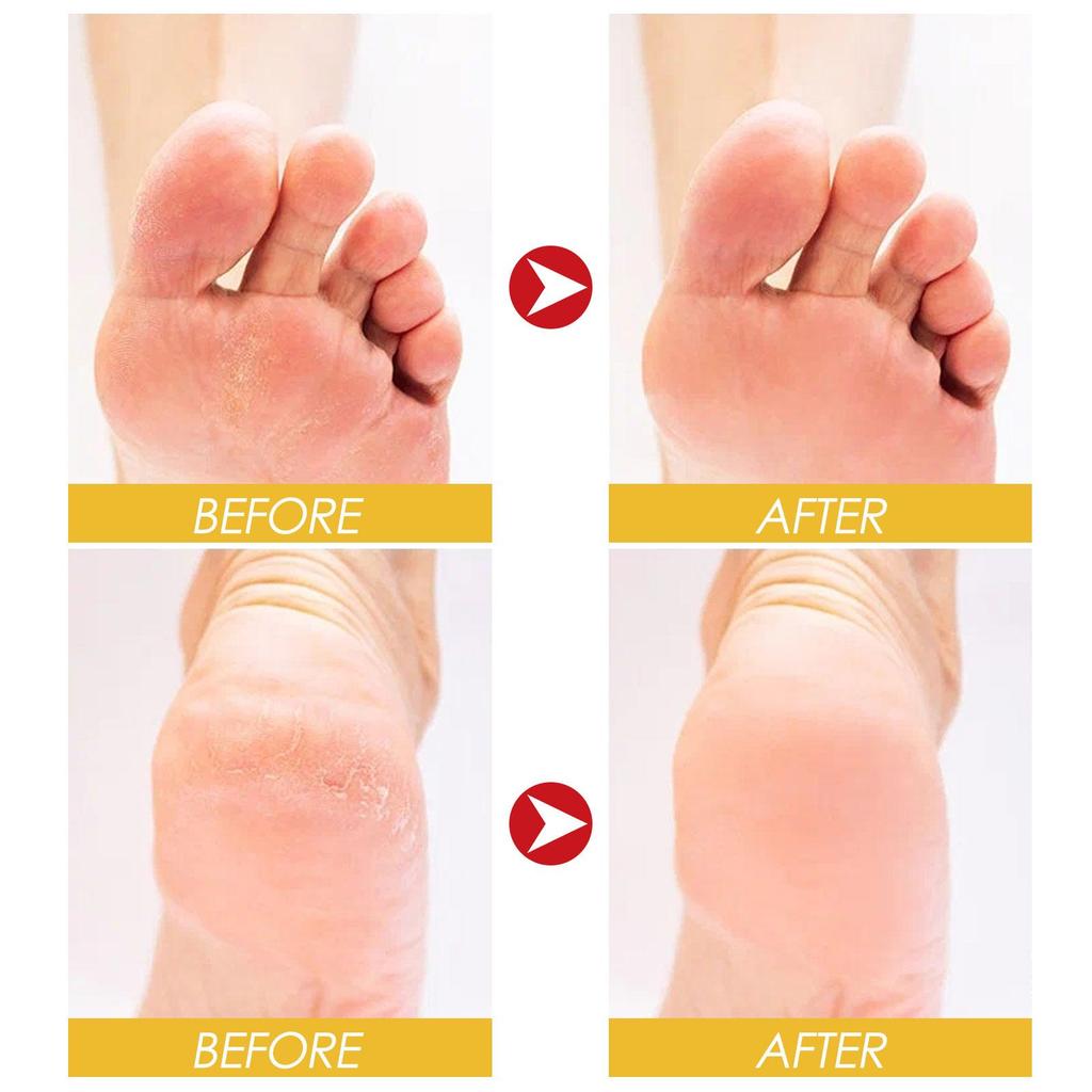 Hoygi Honey and Milk Peel-Off Hand and Foot Mask 150g Whitening Skin  Exfoliating Calluses Hand/foot Skin Treatment Cream Moisturizing Hand Wax