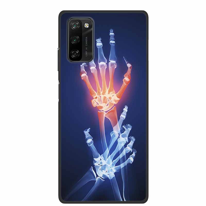 6.67" For Blackview A100 Case Fashion Photos Black Silicone Soft Phone Case For Blackview A100 Back Cover Case A 100 Funda Coque