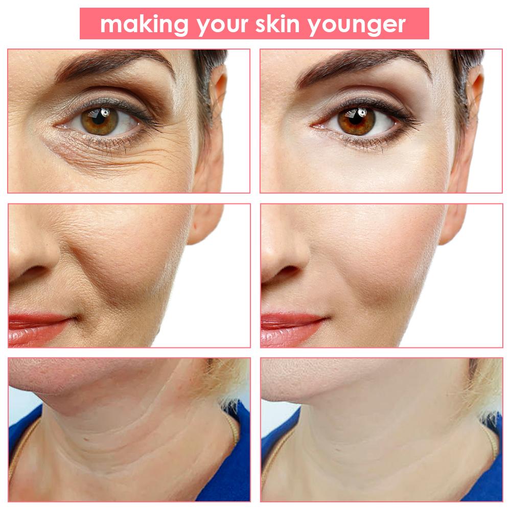 5-color LED EMS Face Lifting Massager Microcurrent Skin Rejuvenation Care IPL Facial Importer Face Tightening Beauty Device