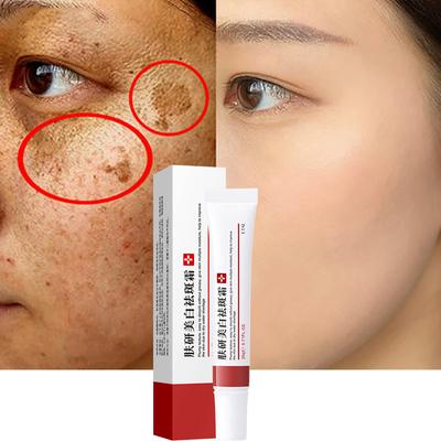 Face Whitening Freckle Cream Remove Melasma Cream Remove Dark Spots Melanin Melasma Remover Brighten Skin Anti-Aging Skin Lightening Cream