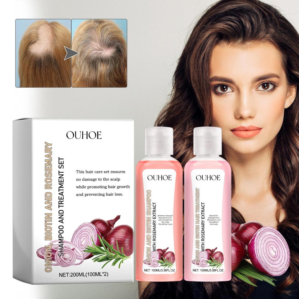 Zwiebel-Biotin-Rosmarin-Shampoo-Set nährt Haarwurzeln und Kopfhaut