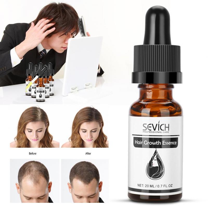 Buy 20ml Hair Growth Essence Oil Ginseng Scalp Health Hair Loss Treatment Liquid at affordable