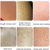Body Whitening Cream Keratosis Pilaris Treatment Bumpy Rough Chicken Follicle Skin Repair Strawberry Legs Removal Dry Skin Care