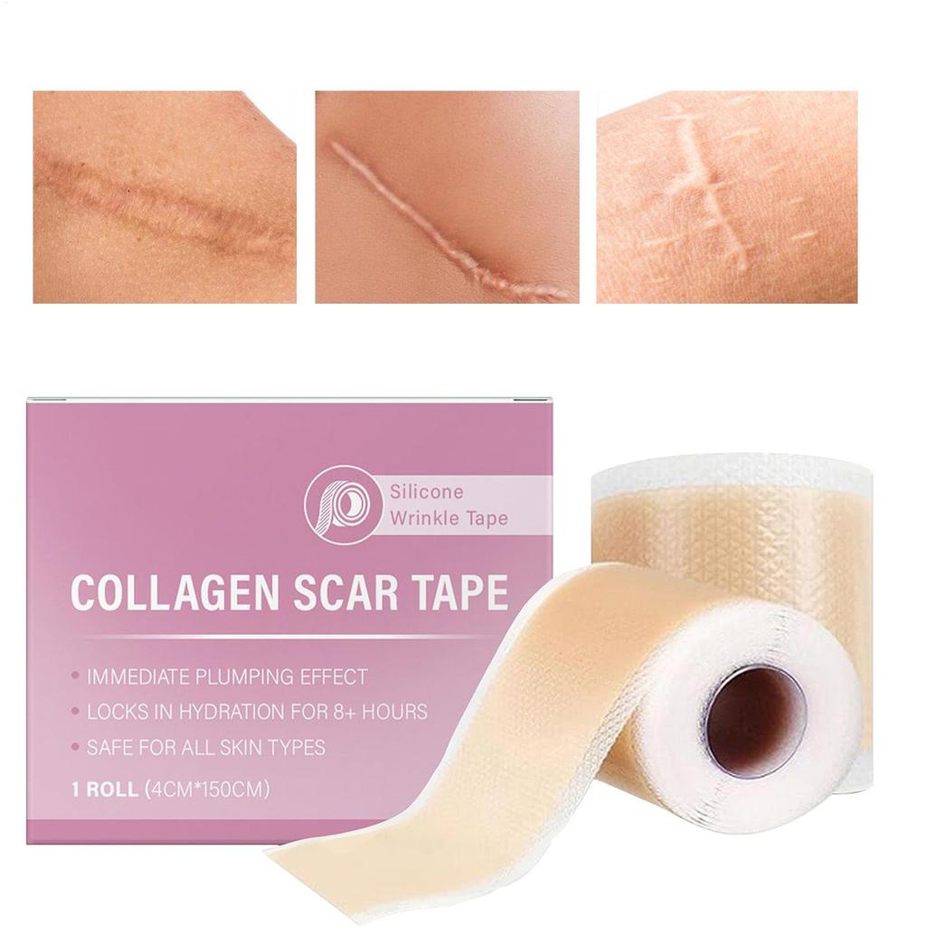 Scar Sheets 1 Roll Self-Adhesive Scar Cover Tape Skin Care Waterproof and Breathable