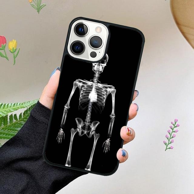 Röntgenaufnahme Menschliche Anatomie Handyhülle Für iPhone 17 Air 15 16 16e 11 12 13 14 Pro Max Hülle Für iPhone 17 Air Max Plus coque Fundas