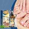 Bikval Nagelkroppslotion Uppljusande, Närande, Skydd mot Svamp & Bakterier, 30 ml