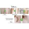3pcs 5 Mins Painless Hair Removal Spray Powerful Hair Removal Cream Effective for Women Pubic & Bikini Area Armpit