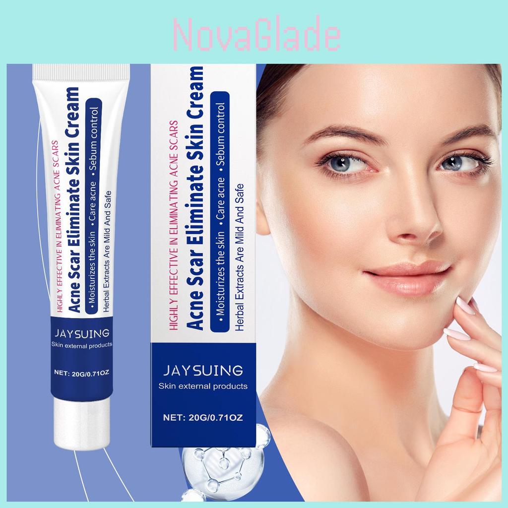 Jaysuing Herbal Acne Cream Refreshing Oil Control Gentle Cleansing Moisturizer For Skin