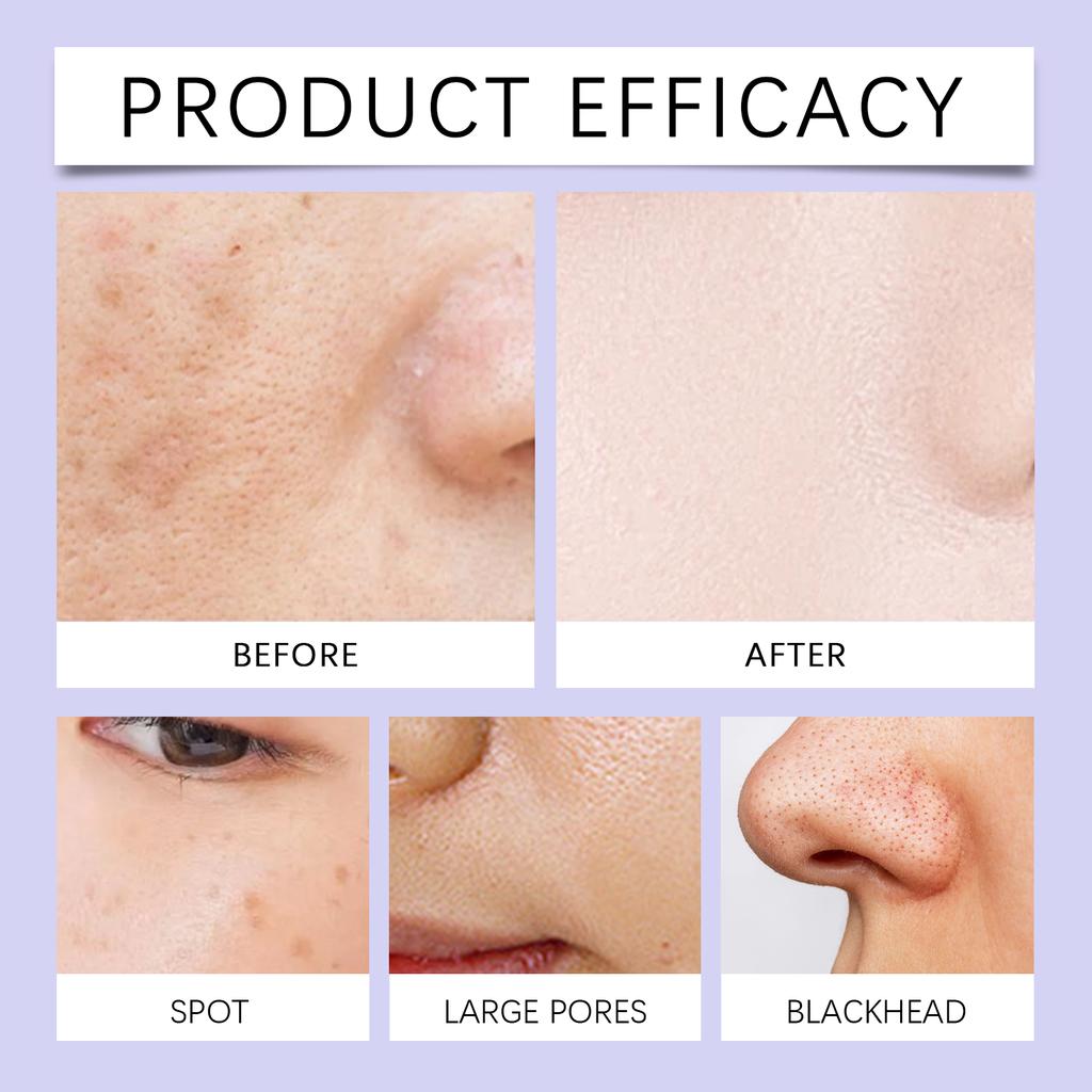 Facial Care Gel Gentle Nourishing Facial Spots Hydration Skin Firming Care Gel