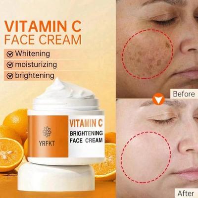 2022 Vitamin C Brightening Cream Improves Black Spot Whitening Cream To Repair Faded Skin, Freckles and Melanin Skin Care Products